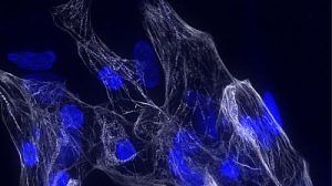 Immagine rappresentativa di cardiomiociti umani derivati da cellule staminali pluripotenti